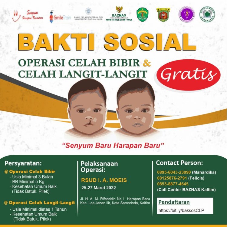 Baznas Gratiskan Operasi Celah Bibir dan Langit-Langit. Badrus: Bhakti Sosial untuk Menolong Ummat