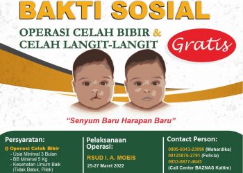 Baznas Gratiskan Operasi Celah Bibir dan Langit-Langit. Badrus: Bhakti Sosial untuk Menolong Ummat